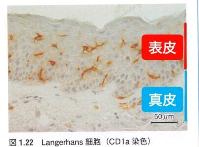 120-Langerhanscell